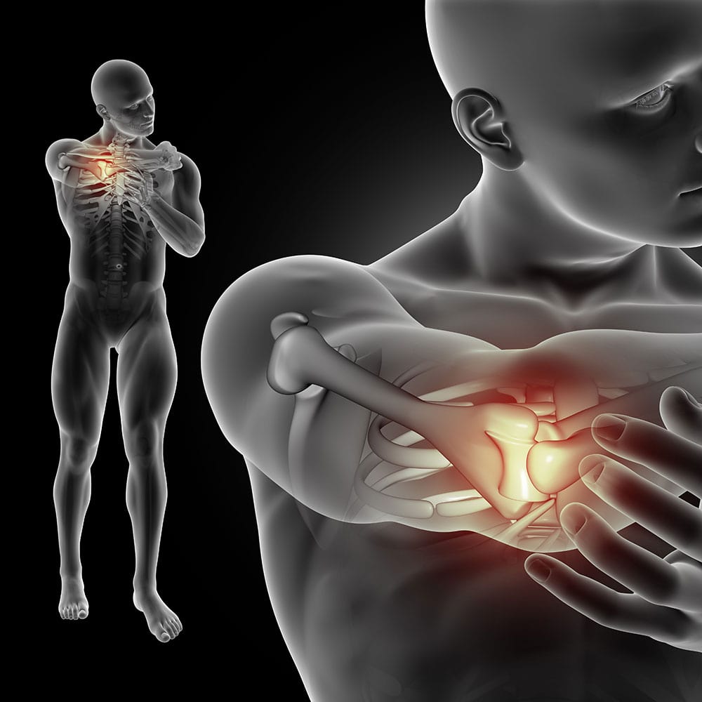 Musculoskeletal Conditions (2)