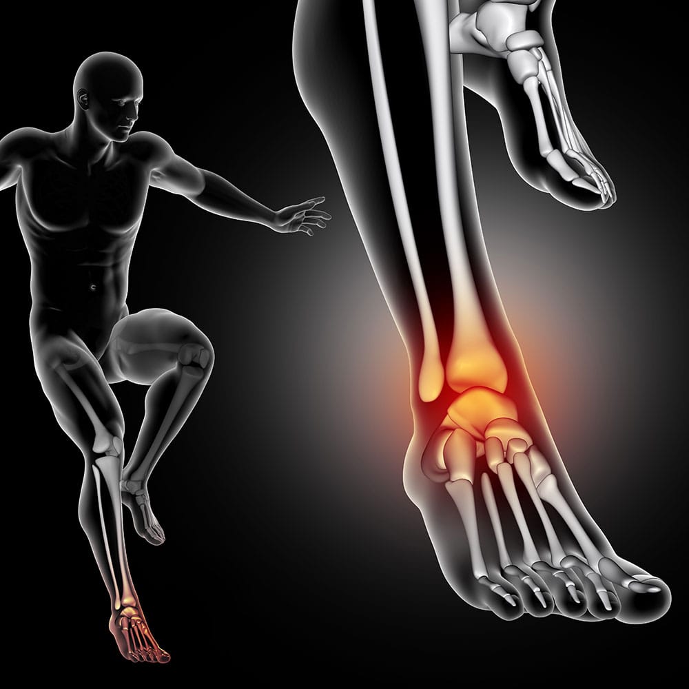 Musculoskeletal Conditions (4)
