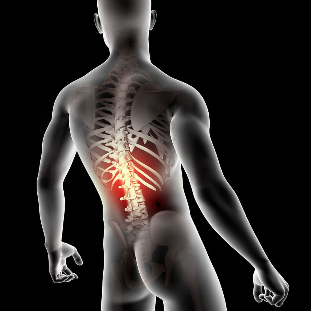 Musculoskeletal Conditions (6)